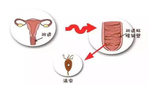 ͼƬ,֢״,ԭ,